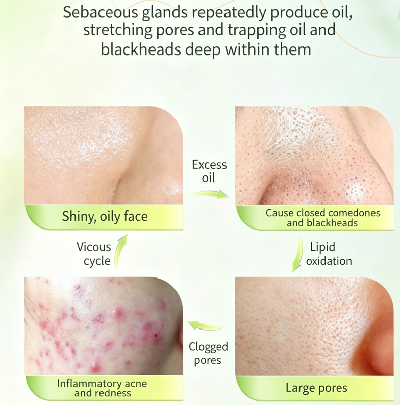 The Green Clean | Chlorophyll + Amino Acid Face Wash – Deep Pore Cleansing, Gentle Enough for Daily Use